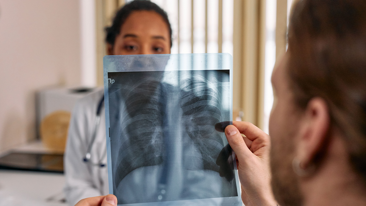 Un pacient sosté una radiografia de tòrax davant una metgessa que l'analitza al consultori.