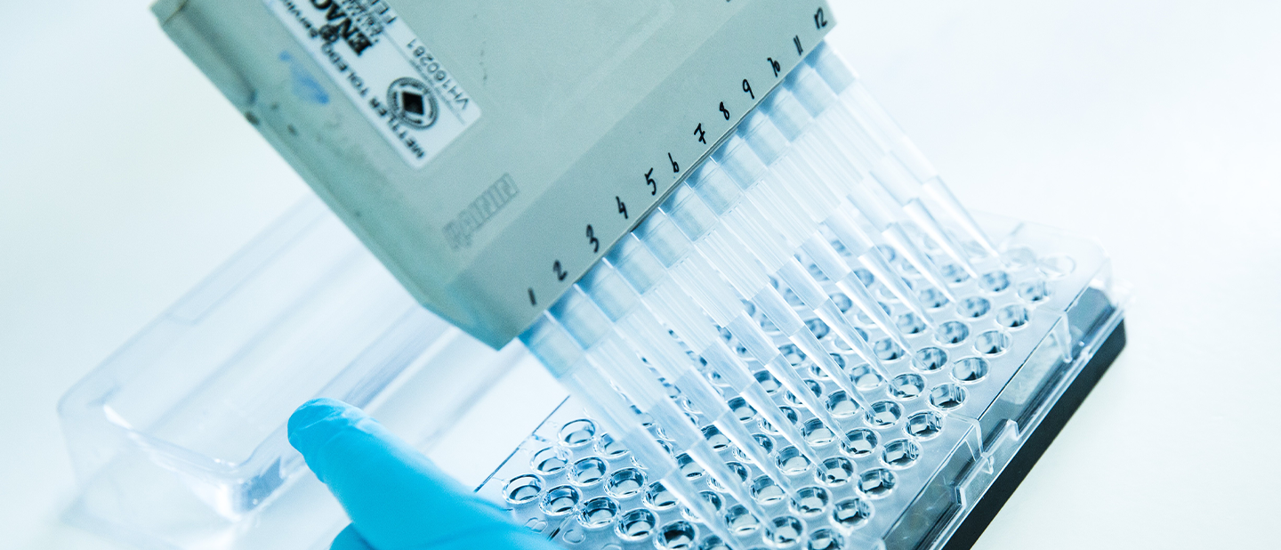 Proceso de cribado molecular con pipeta multicanal para la investigación de enfermedades en la farmacéutica de Ferrer.