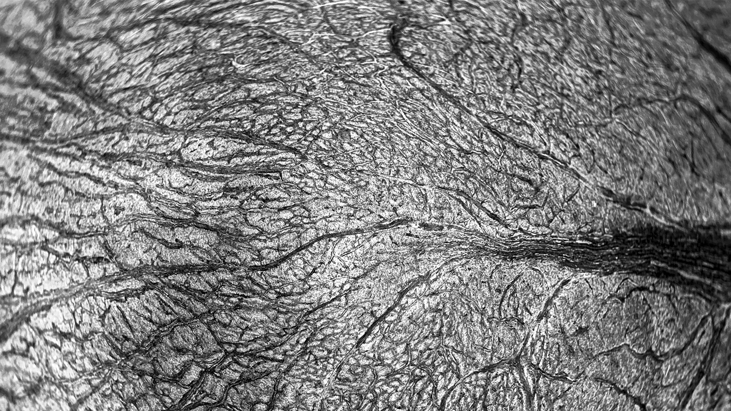 Concepte visual de rigidesa arterial i resistència en els vasos pulmonars, representatiu de la investigació científica en Hipertensió Pulmonar per Ferrer.