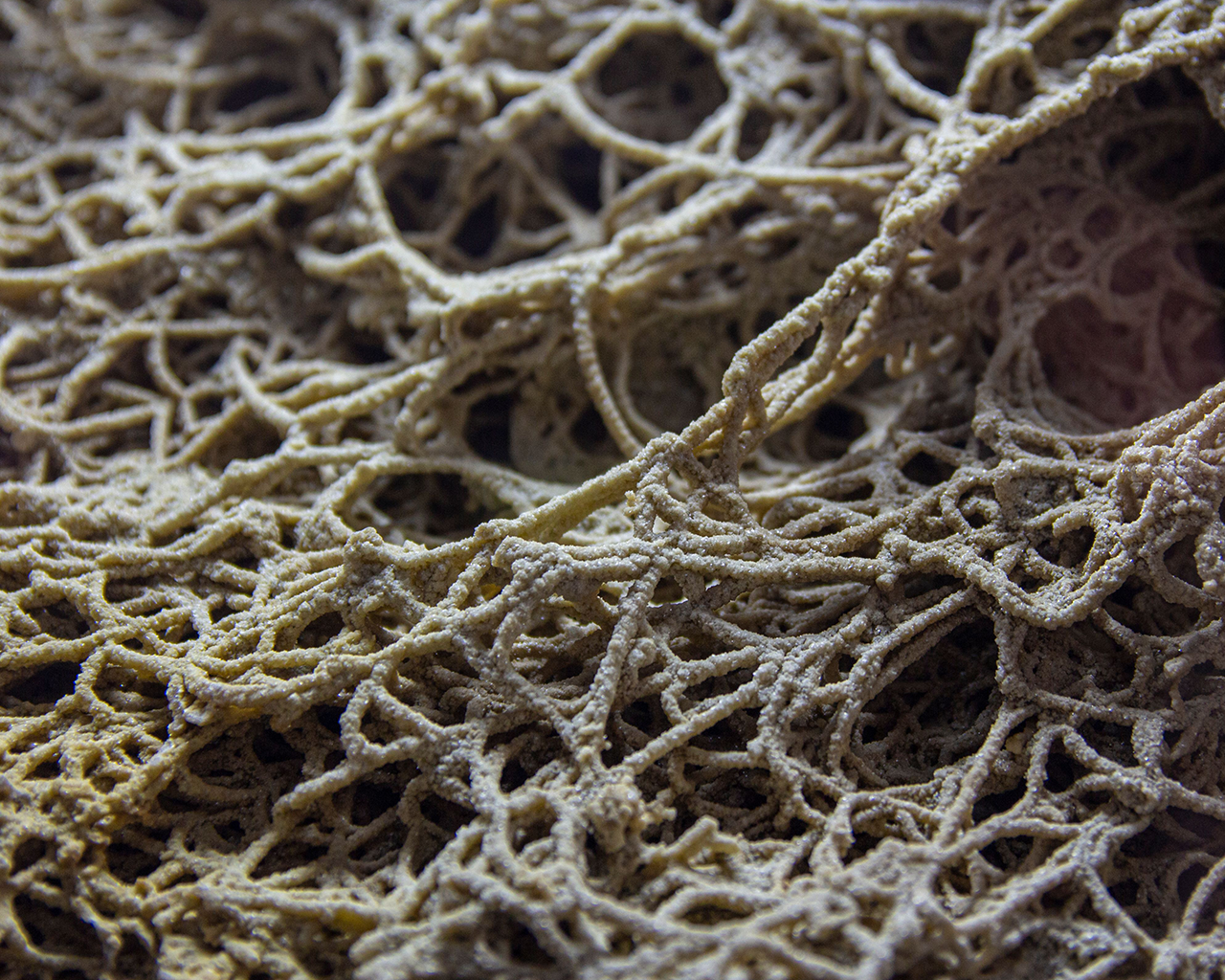 Análisis microscópico de biomarcadores en tejido fibrótico pulmonar, clave en el desarrollo de fármacos innovadores para la Fibrosis Pulmonar Idiopática por Ferrer.