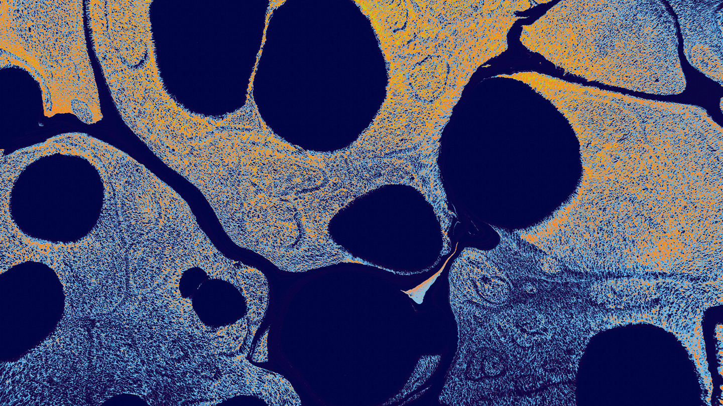 Vista microscópica de tejido celular para la investigación científica de la Esclerosis Lateral Amiotrófica dentro del área de enfermedades neurológicas de Ferrer.