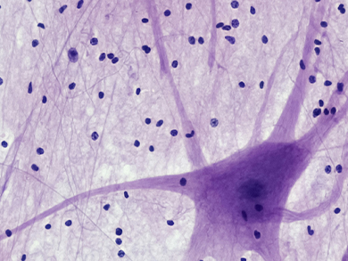 Muestra de tejido neuronal analizada para la investigación farmacológica de la Parálisis Supranuclear Progresiva en el pipeline de Ferrer.