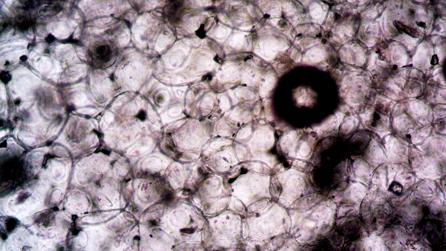 Macroscopic sample of the alveolar structure for the study and development of therapies against Pulmonary Hypertension associated with Interstitial Lung Disease in Ferrer.