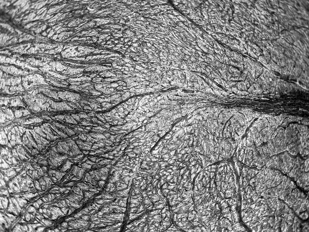 Concepte visual de rigidesa arterial i resistència en els vasos pulmonars, representatiu de la investigació científica en Hipertensió Pulmonar per Ferrer.
